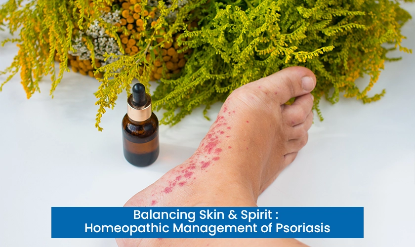 Balancing Skin & Spirit : Homeopathic Management of Psoriasis